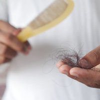 Tratamiento Alopecias